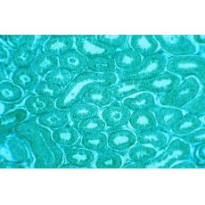 小鼠前胃癌低轉移細胞（綠色熒光蛋白標記）；MFC-B5-GFP	